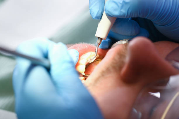 Best Emergency Treatment for Toothache in Soda Springs, ID